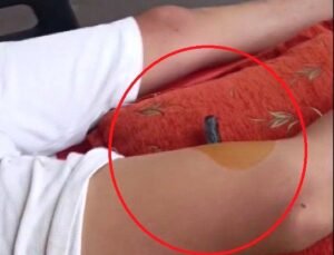 Bahçeye kaçan topu almak isteyen çocuğun bacağına korkuluk demiri saplandı