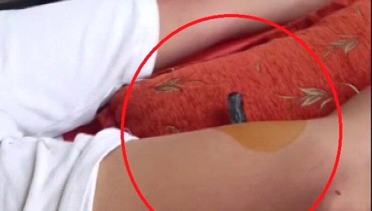 Bahçeye kaçan topu almak isteyen çocuğun bacağına korkuluk demiri saplandı